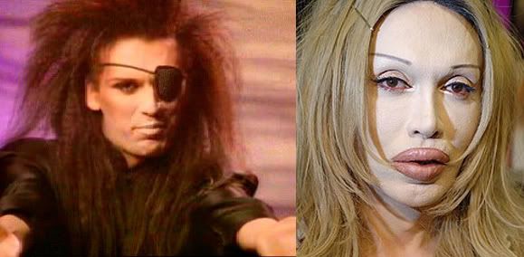pete burns before and after. failure pete burns hands