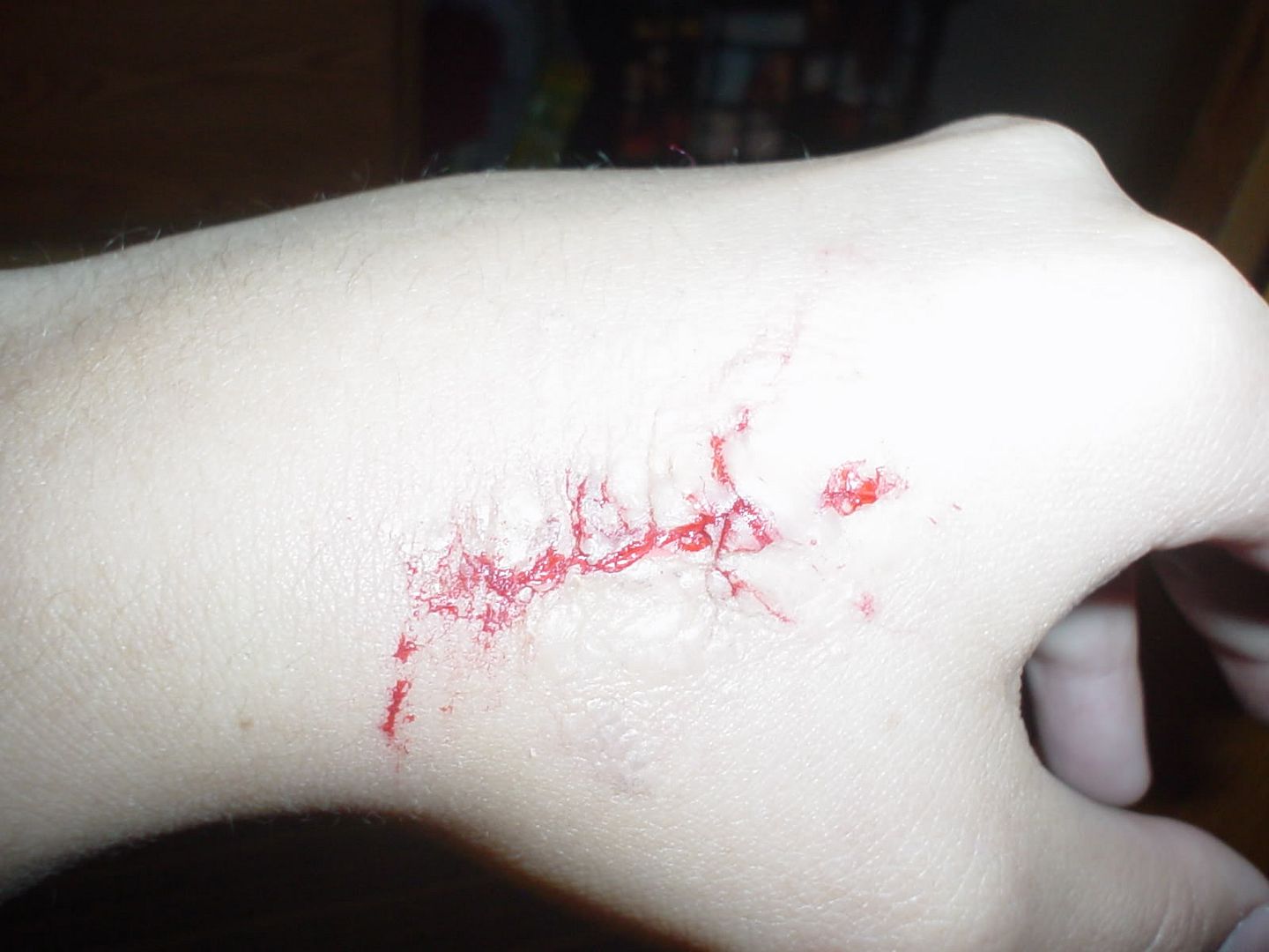 110e.jpg close up cut on hand image by civettuolo18