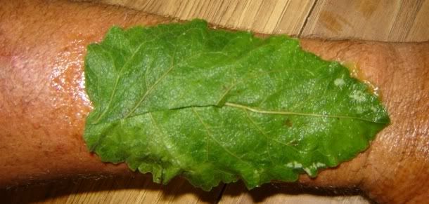 salve and scalded burdock leaf over the burn Pictures, Images and Photos