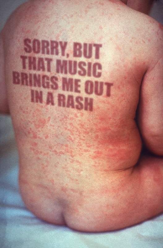 Rash_of_rubella_on_skin_of_childs_back.jpg